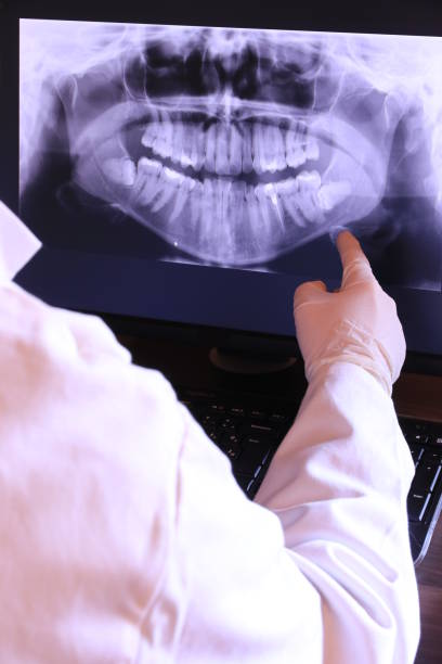 Best Emergency Dental Care for Broken or Chipped Teeth in Dermott, AR